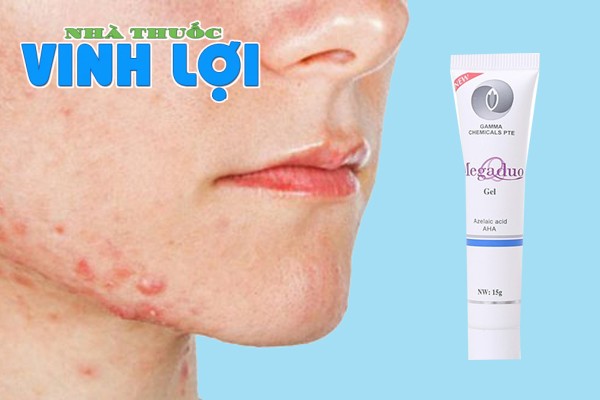 Chỉ định sử dụng thuốc Megaduo Gel