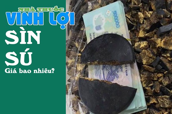 Sìn Sú giá bao nhiêu?