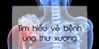 Cùng có cái nhìn tổng quát về bệnh ung thư xương