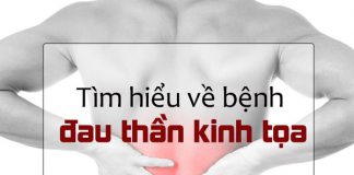 Giải đáp thắc mắc của bạn về bệnh Đau dây thần kinh tọa và phương pháp điều trị phù hợp