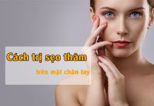 Cách trị sẹo thâm lâu năm