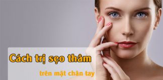 Cách trị sẹo thâm lâu năm