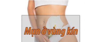 Mụn ở vùng kín ảnh hưởng sức khỏe, tâm sinh lý cho phái nữ