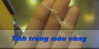 Tinh trùng biến đổi vàng - một hiện tượng bất thường