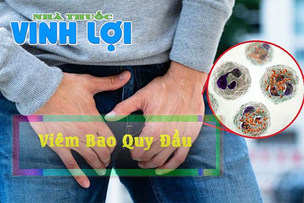 viêm bao quy đầu