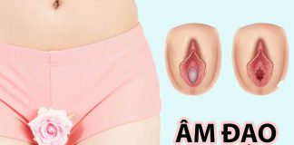 Âm đạo đẹp
