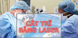 cắt trĩ bằng laser