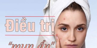 Phương pháp điều trị mụ ẩn