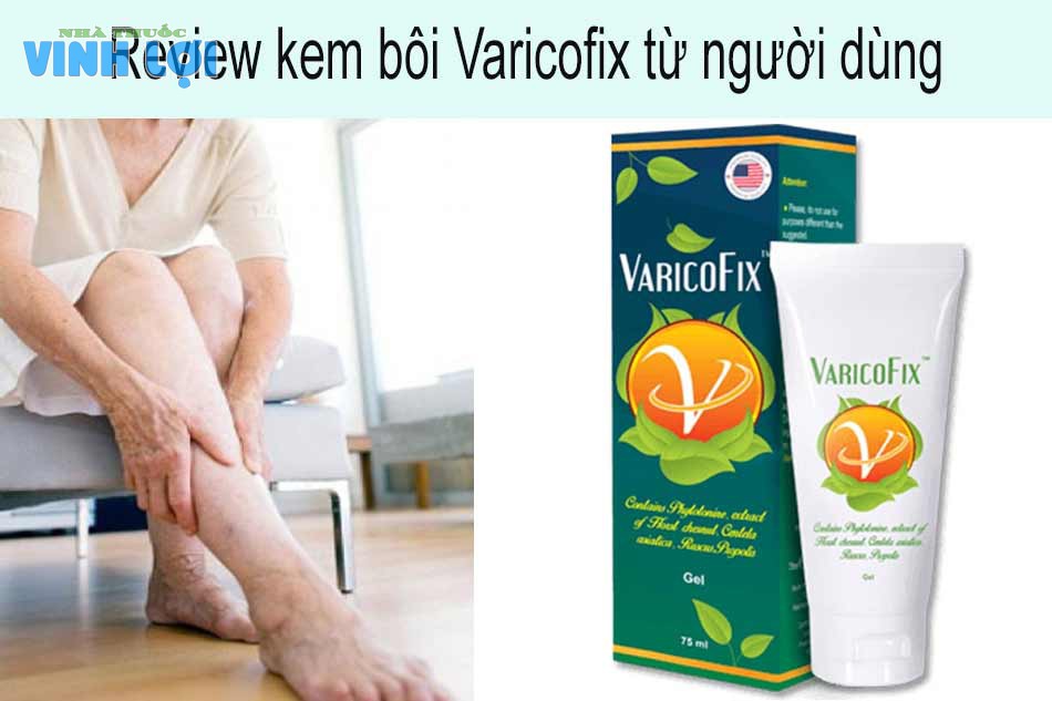 Review kem bôi giãn tĩnh mạch Varicofix từ người dùng