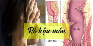 Rò hậu môn