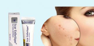 Kem trị sẹp Scar Esthetique