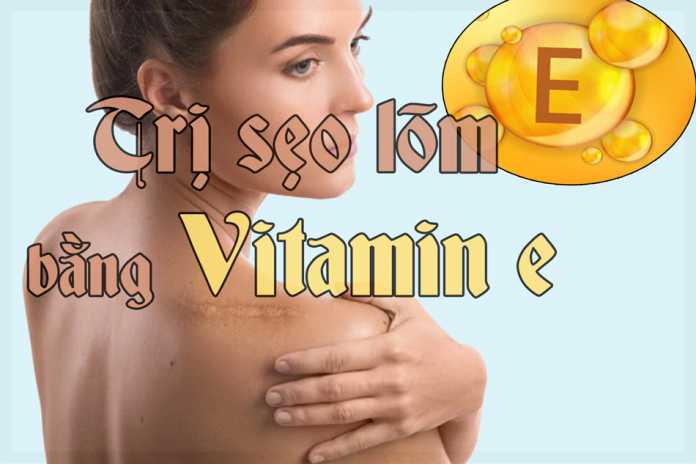 Trị sẽo rỗ bằng vitamin e