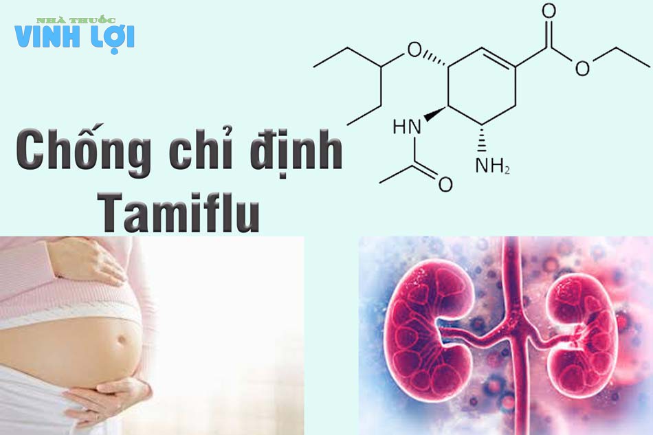 Chống chỉ định thuốc cúm A Tamiflu
