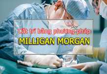 Phương pháp Milligan Morgan