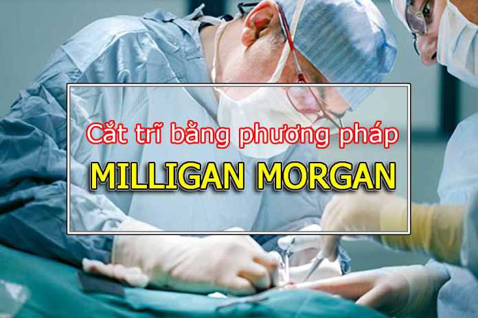 Phương pháp Milligan Morgan