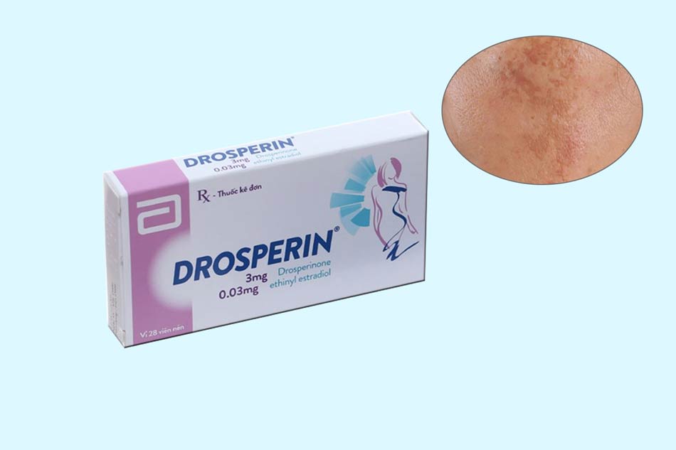 Thuốc tránh thai Drosperin và nám da