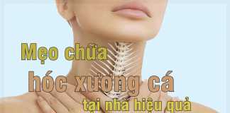 Chữa hóc xương cá