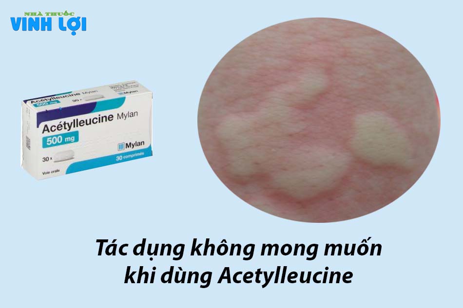 Tác dụng không mong muốn khi dùng Acetylleucine