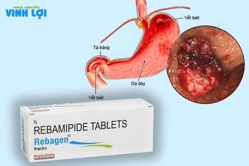 Thành phần chính của thuốc là Rebamipide với hàm lượng 100mg