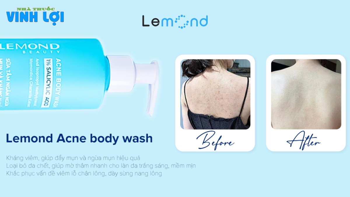 Trước và sau khi sử dụng sữa tắm Lemond Acne Body Wash