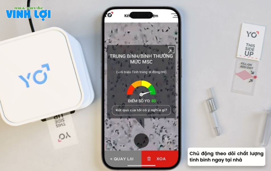 Kiểm tra tinh dịch đồ là bước quan trọng để tăng cơ hội săn quý tử