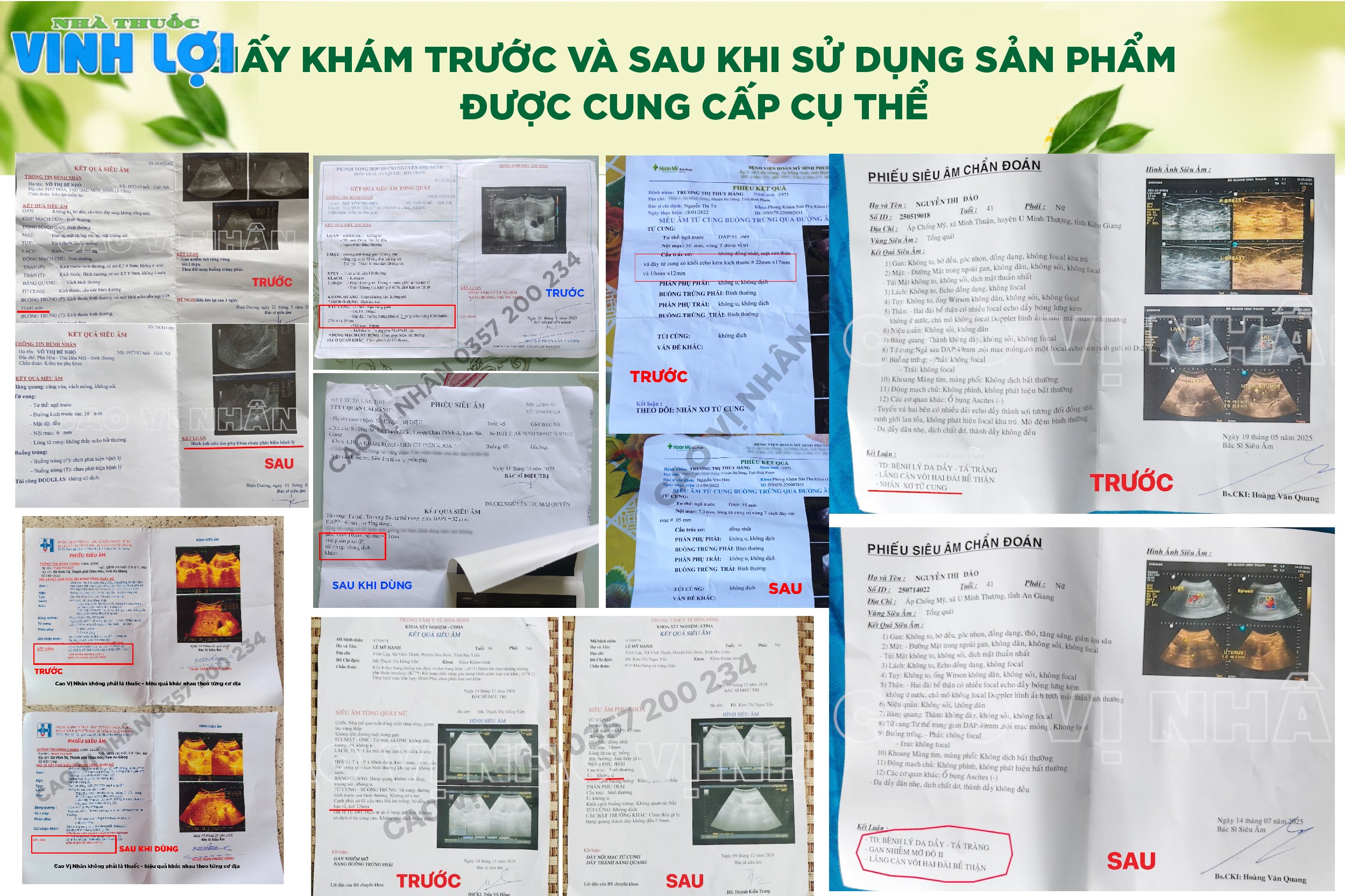 Hồ sơ thăm khám trước và sau khi sử dụng sản phẩm được cung cấp cụ thể
